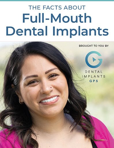The Facts About Full-Mouth Dental Implants